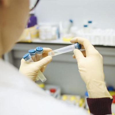 Covid-19 Test Labs